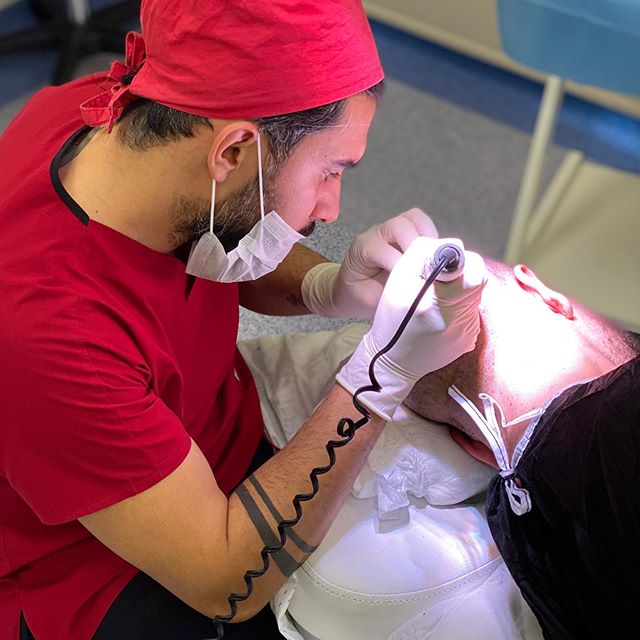 Fue Haartransplantatie Behandeling - Afbeelding 2